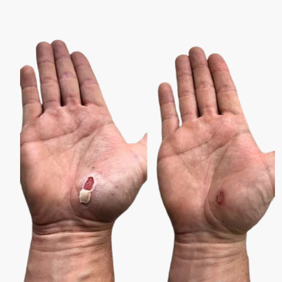 FIX IT - Hand Care Tube 14g - 5 STK